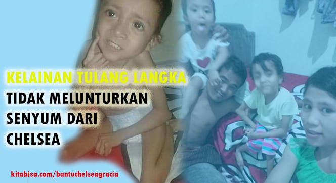 Bantu Chelsea manullang untuk berdiri & berjalan