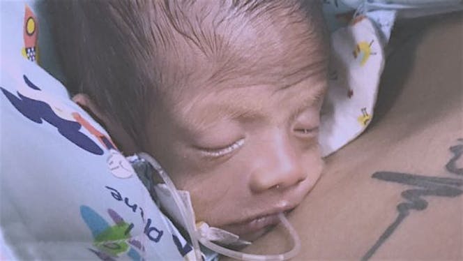 Bantu Ade Kenaan si pejuang NICU