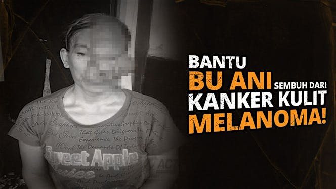 Bantu Ibu Ani Lawan Kanker Kulit Melanoma
