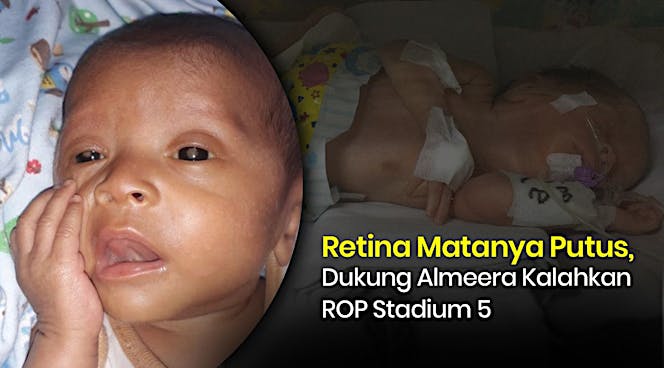 Bantu Almeera Untuk Bisa Melihat Orang Tuanya