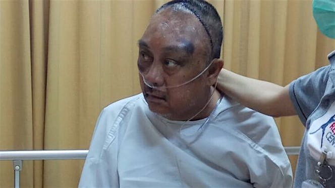 Bantu Pak Samad dalam melawan tumor otak