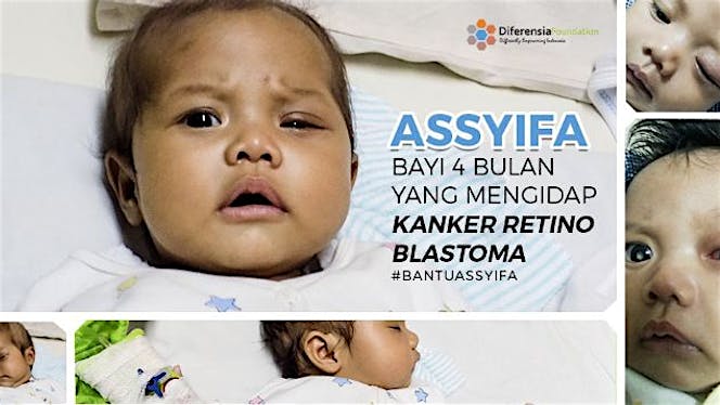 Bantu Assyifa Lawan Retinoblastoma