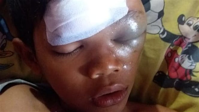Bantu Bintang melawan Gegar Otak