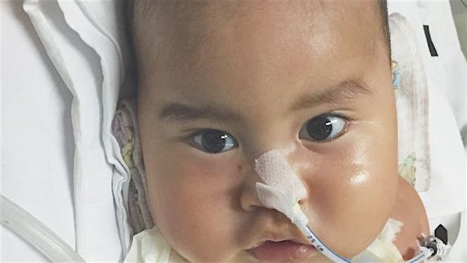 Bantu Fabian untuk Membeli Ventilator