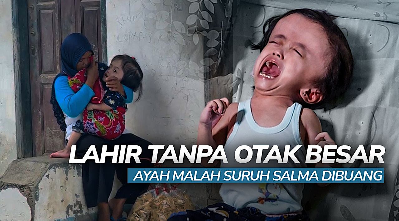 Ayah Suruh 'Buang' Anak Karena Lahir Tak Sempurna