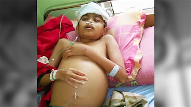 Bantu Rafi sembuh Dari Kanker Darah/Leukimia.