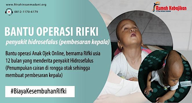 Bantu Operasi Rifki (Penyakit Hidrosefalus)