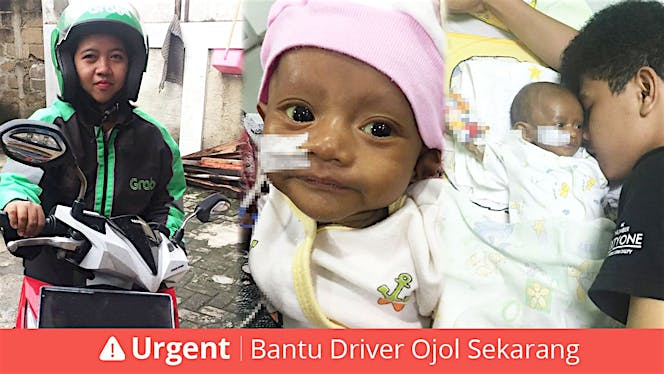 Bantu Azka melawan Alagille Syndrome