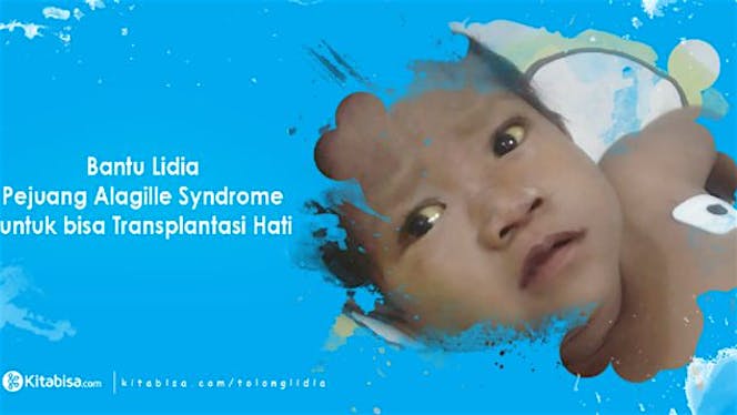 Bantu Lidia untuk Transplantasi Hati