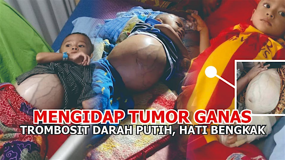 Raja Idap Tumor Ganas Dan Dua Penyakit Lainnya